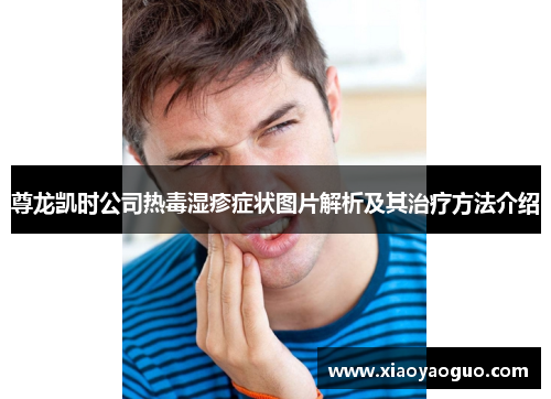 尊龙凯时公司热毒湿疹症状图片解析及其治疗方法介绍